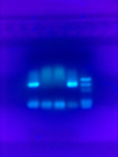 Gelelektrophorese